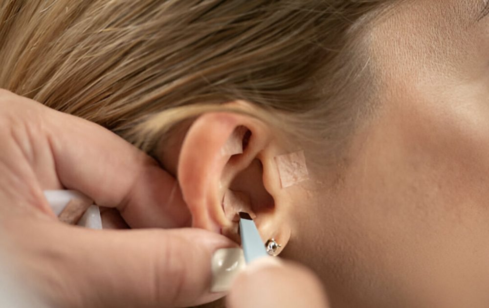 auticuloterapia (1) auticuloterapia (1)